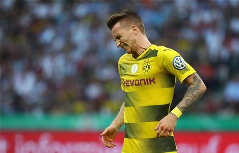 Marco Reus
